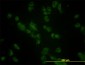 GBA Antibody (monoclonal) (M01)